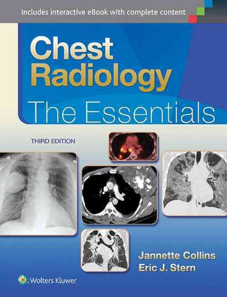 Produktbild: Chest Radiology
