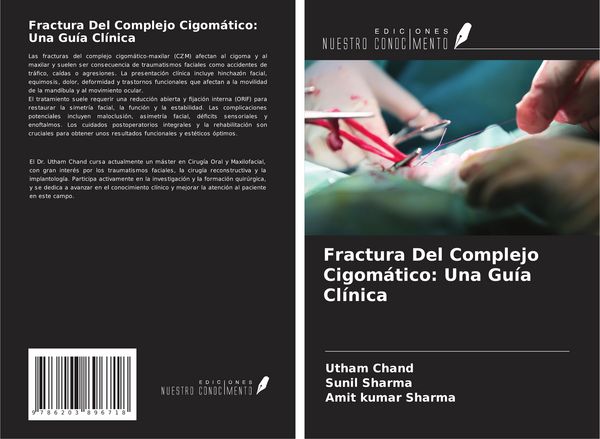 Produktbild: Fractura Del Complejo Cigom&aacute;tico: Una Gu&iacute;a Cl&iacute;nica