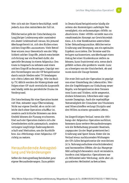 Produktbild: Meine Adipositas-OP. Magenverkleinerung, Magenband, Bypass & Co.