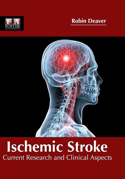 Produktbild: Ischemic Stroke