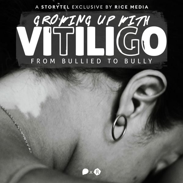 Produktbild: Growing Up With Vitiligo, I Was Bullied&mdash;Until I Became A Bully