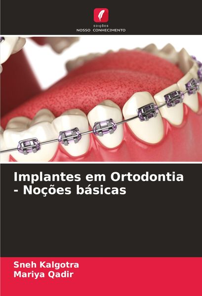 Produktbild: Implantes em Ortodontia - No&ccedil;&otilde;es b&aacute;sicas