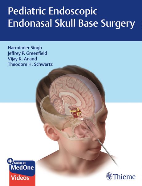 Produktbild: Pediatric Endoscopic Endonasal Skull Base Surgery