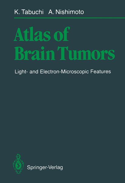Produktbild: Atlas of Brain Tumors