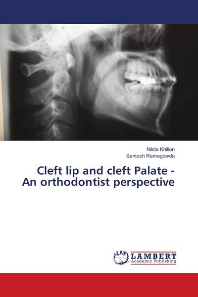 Produktbild: Cleft lip and cleft Palate - An orthodontist perspective