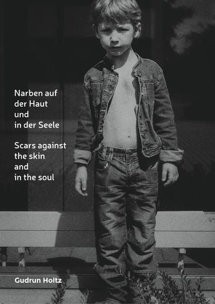Produktbild: Narben auf der Haut und in der Seele