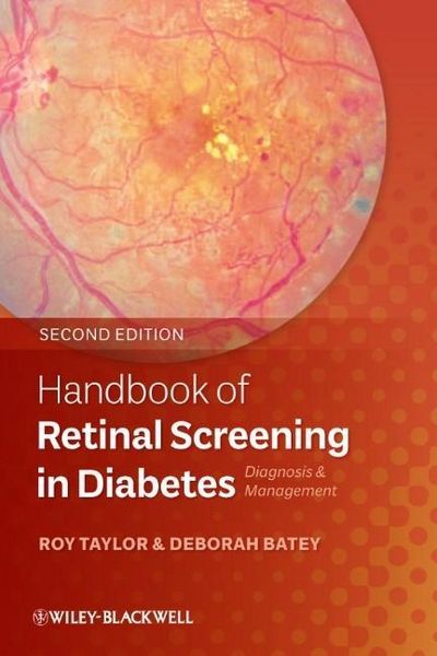 Produktbild: Handbook of Retinal Screening in Diabetes