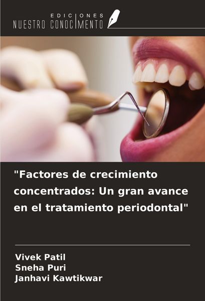 Produktbild: "Factores de crecimiento concentrados: Un gran avance en el tratamiento periodontal"