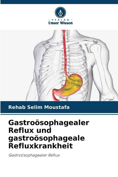 Produktbild: Gastro&ouml;sophagealer Reflux und gastro&ouml;sophageale Refluxkrankheit