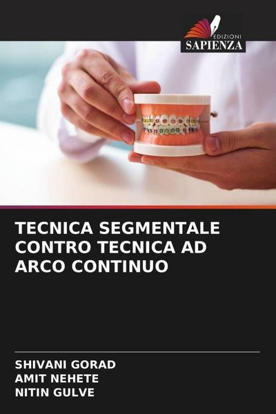 Produktbild: Tecnica Segmentale Contro Tecnica Ad Arco Continuo