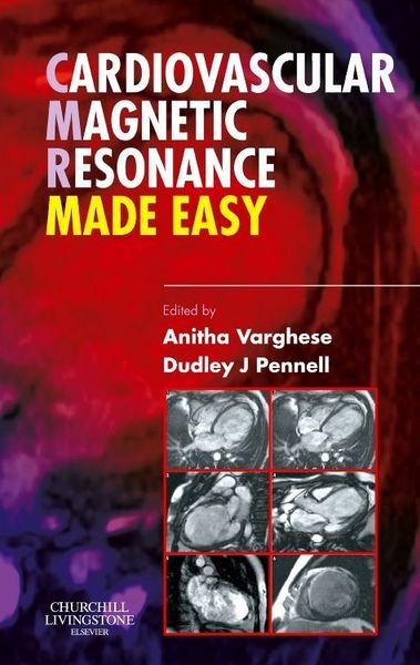 Produktbild: Cardiovascular Magnetic Resonance Made Easy