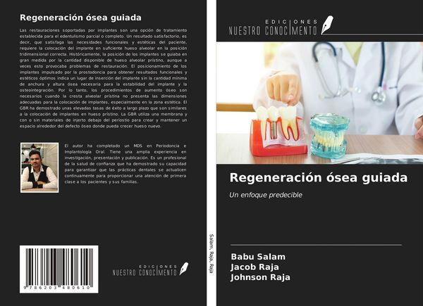 Produktbild: Regeneraci&oacute;n &oacute;sea guiada