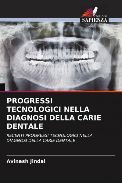 Produktbild: Progressi Tecnologici Nella Diagnosi Della Carie Dentale