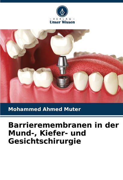 Barrieremembranen in der Mund-, Kiefer- und Gesichtschirurgie