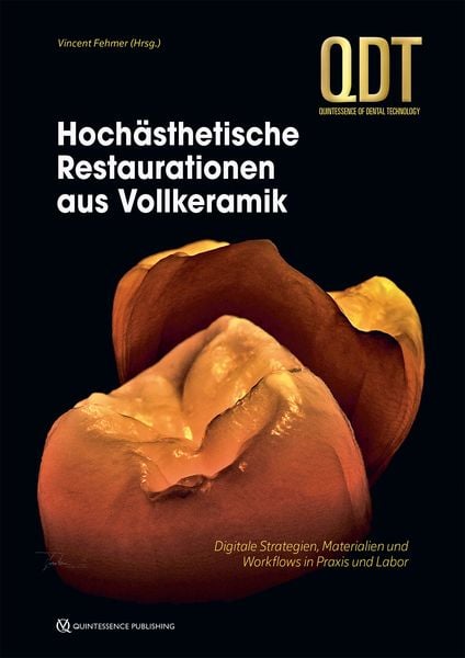 Produktbild: Hoch&auml;sthetische Restaurationen aus Vollkeramik
