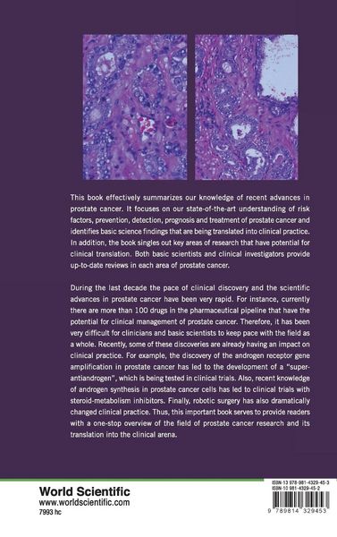Produktbild: Recent Advances in Prostate Cancer