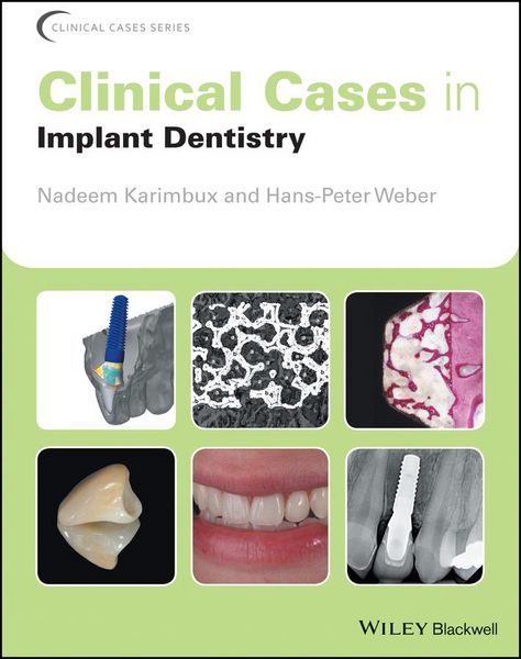 Produktbild: Clinical Cases in Implant Dentistry