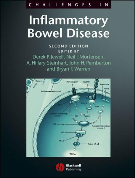 Produktbild: Challenges in Inflammatory Bowel Disease