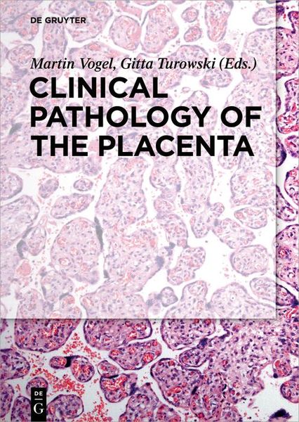 Produktbild: Clinical Pathology of the Placenta