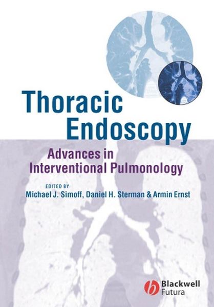 Produktbild: Thoracic Endoscopy