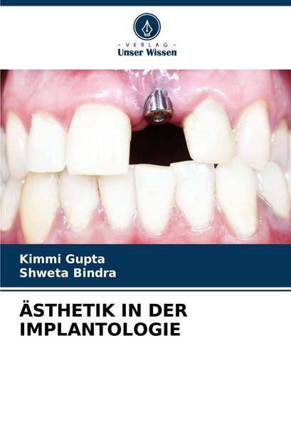 Ästhetik in der Implantologie, Taschenbuch von Kimmi Gupta , Shweta Bindra, Verlag Unser Wissen, 9786206670469
