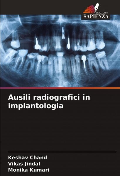 Produktbild: Ausili radiografici in implantologia
