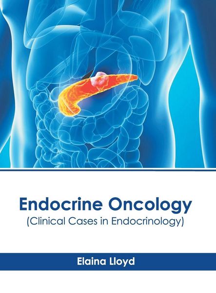 Produktbild: Endocrine Oncology (Clinical Cases in Endocrinology)