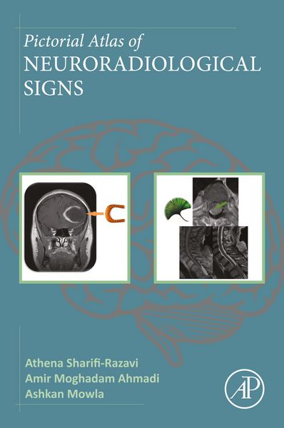 Produktbild: Pictorial Atlas of Neuroradiological Signs