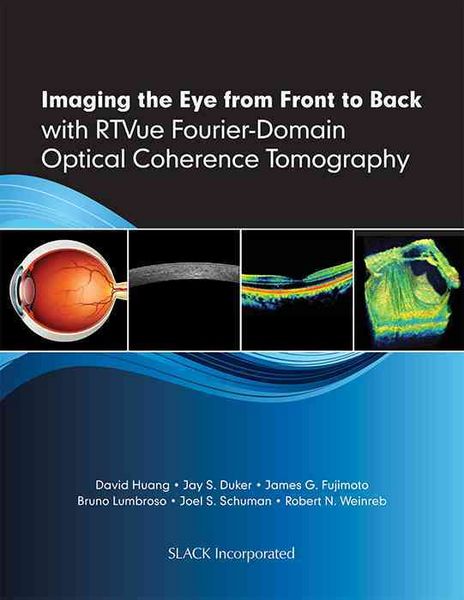 Produktbild: Huang, D:  Imaging the Eye from Front to Back