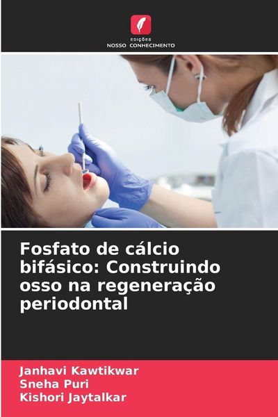 Produktbild: Fosfato de c&aacute;lcio bif&aacute;sico: Construindo osso na regenera&ccedil;&atilde;o periodontal