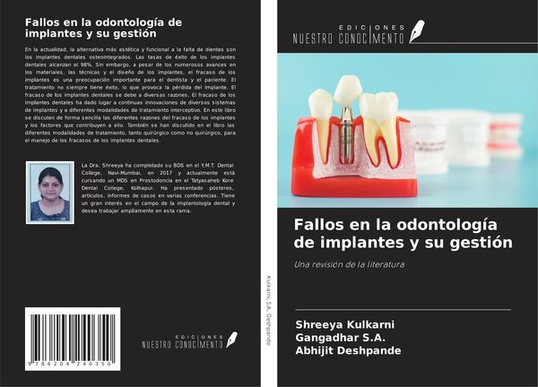 Produktbild: Fallos en la odontolog&iacute;a de implantes y su gesti&oacute;n