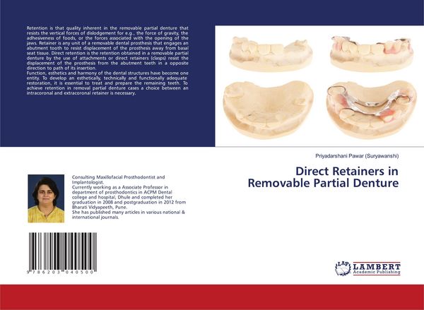 Produktbild: Direct Retainers in Removable Partial Denture