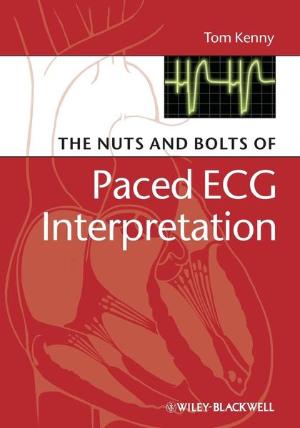 Produktbild: The Nuts and bolts of Paced ECG Interpretation