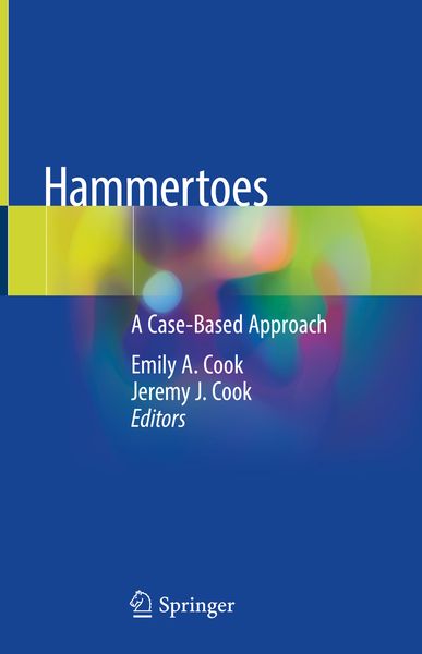 Produktbild: Hammertoes