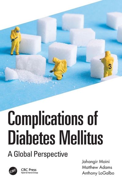 Produktbild: Complications of Diabetes Mellitus