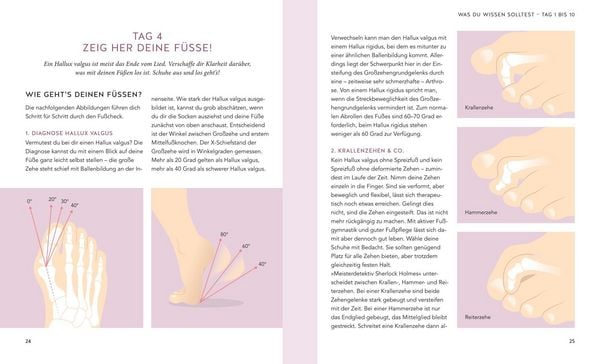 Produktbild: Hallux valgus