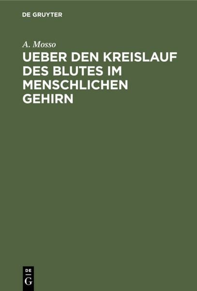 Produktbild: Ueber den Kreislauf des Blutes im menschlichen Gehirn