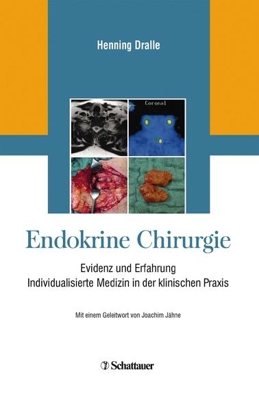 Produktbild: Endokrine Chirurgie