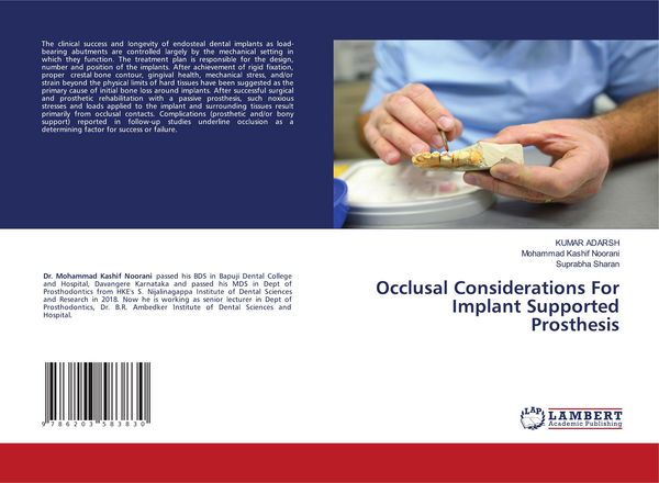Produktbild: Occlusal Considerations For Implant Supported Prosthesis
