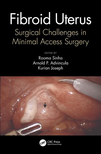 Produktbild: Fibroid Uterus