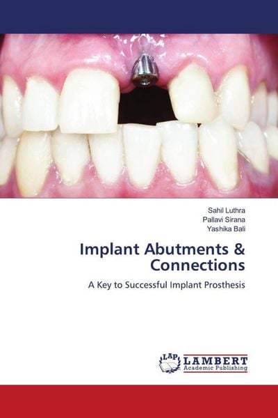 Produktbild: Implant Abutments & Connections
