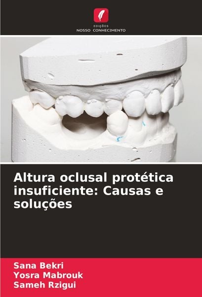 Produktbild: Altura oclusal prot&eacute;tica insuficiente: Causas e solu&ccedil;&otilde;es