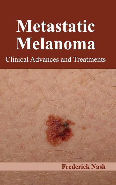 Produktbild: Metastatic Melanoma