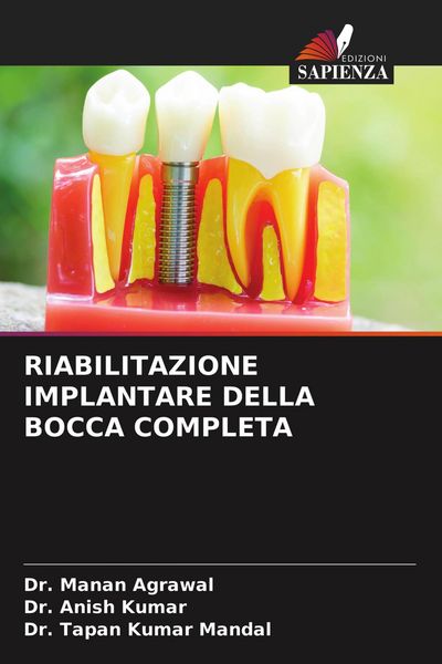 Produktbild: Riabilitazione Implantare Della Bocca Completa