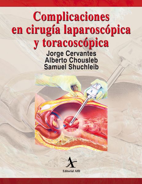 Produktbild: Complicaciones en cirug&iacute;a laparosc&oacute;pica y toracosc&oacute;pica
