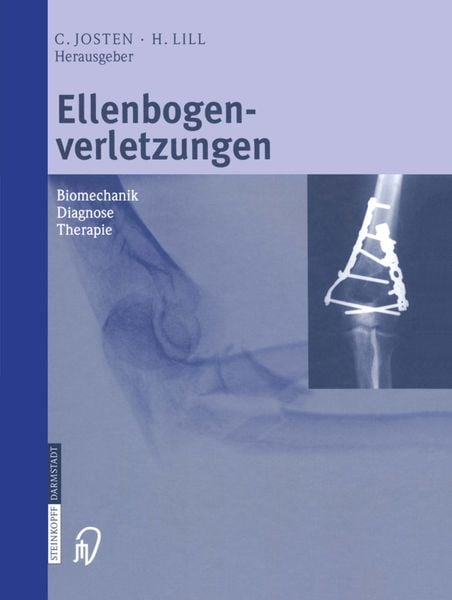 Produktbild: Ellenbogenverletzungen