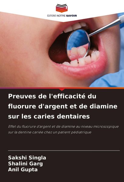 Produktbild: Preuves de l'efficacit&eacute; du fluorure d'argent et de diamine sur les caries dentaires