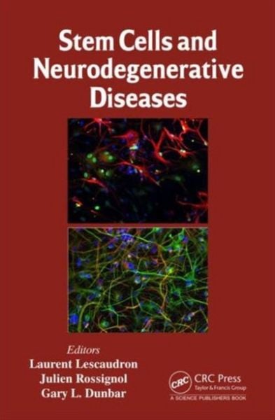 Produktbild: Stem Cells and Neurodegenerative Diseases