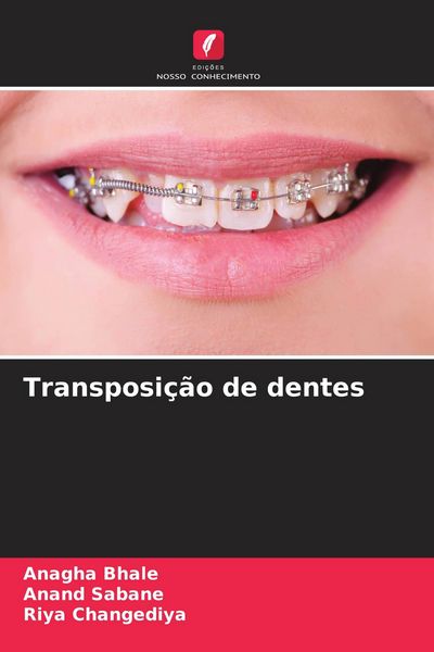 Produktbild: Transposi&ccedil;&atilde;o de dentes