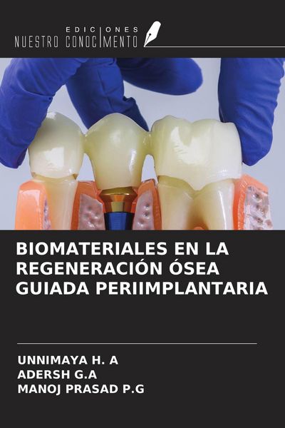 Produktbild: BIOMATERIALES EN LA REGENERACI&Oacute;N &Oacute;SEA GUIADA PERIIMPLANTARIA